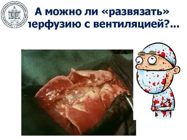  А можно ли «развязать» перфузию с вентиляцией? . . . 