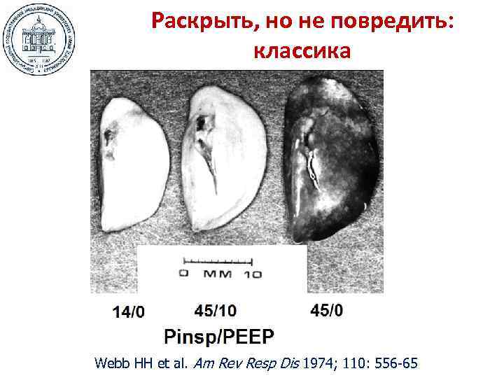   Раскрыть, но не повредить:   классика Webb HH et al. Am