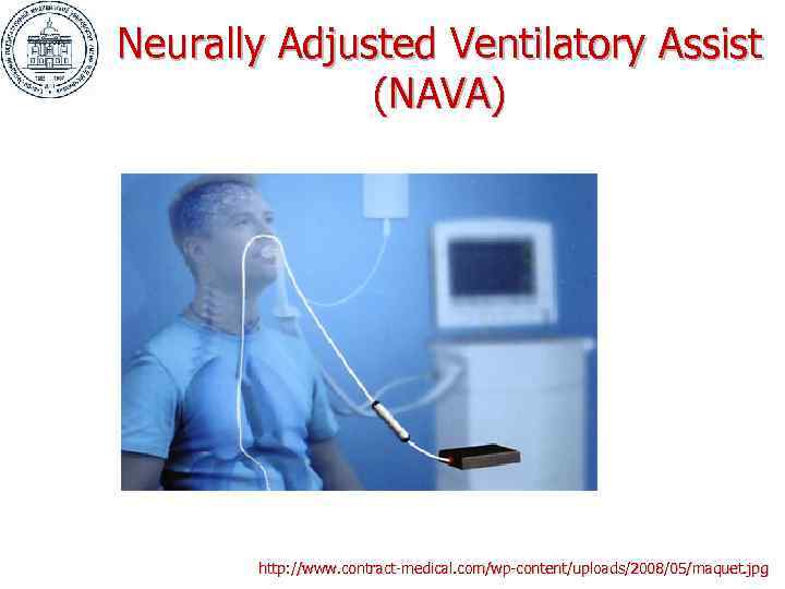 Neurally Adjusted Ventilatory Assist    (NAVA)  http: //www. contract-medical. com/wp-content/uploads/2008/05/maquet. jpg