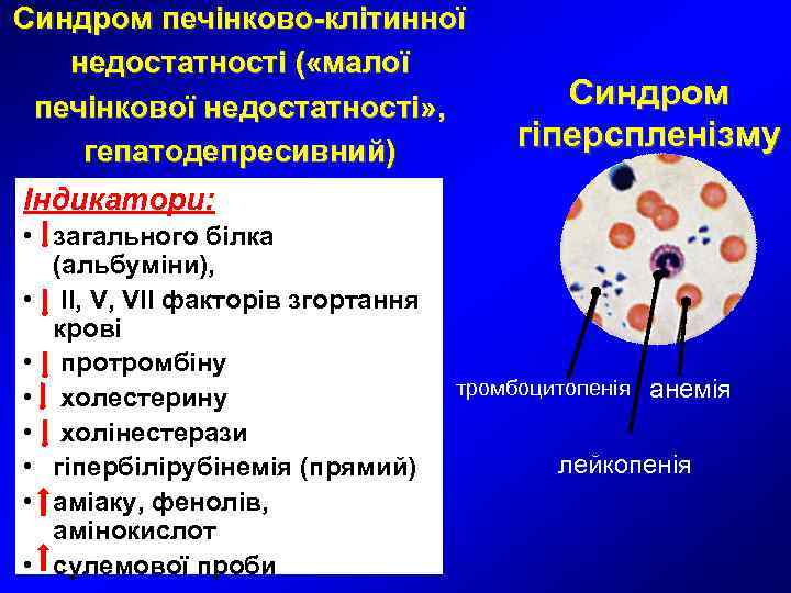 Синдром печінково-клітинної недостатності ( «малої  печінкової недостатності» ,   Синдром гепатодепресивний) 
