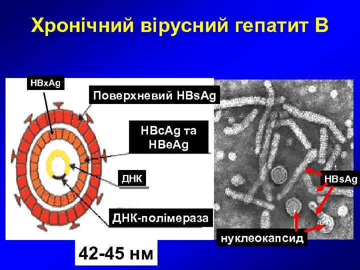 Хронічний вірусний гепатит В HBx. Ag   Поверхневий HBs. Ag   HBc.
