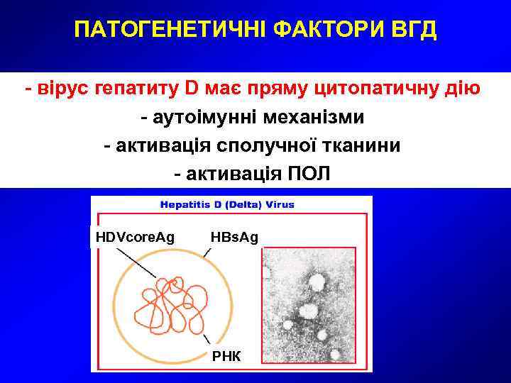  ПАТОГЕНЕТИЧНІ ФАКТОРИ ВГД - вірус гепатиту D має пряму цитопатичну дію 