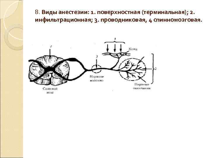 8. Виды анестезии: 1. поверхностная (терминальная); 2. инфильтрационная; 3. проводниковая, 4 спинномозговая. 8. Виды анестезии: 1. поверхностная (терминальная); 2. инфильтрационная; 3. проводниковая, 4 спинномозговая.