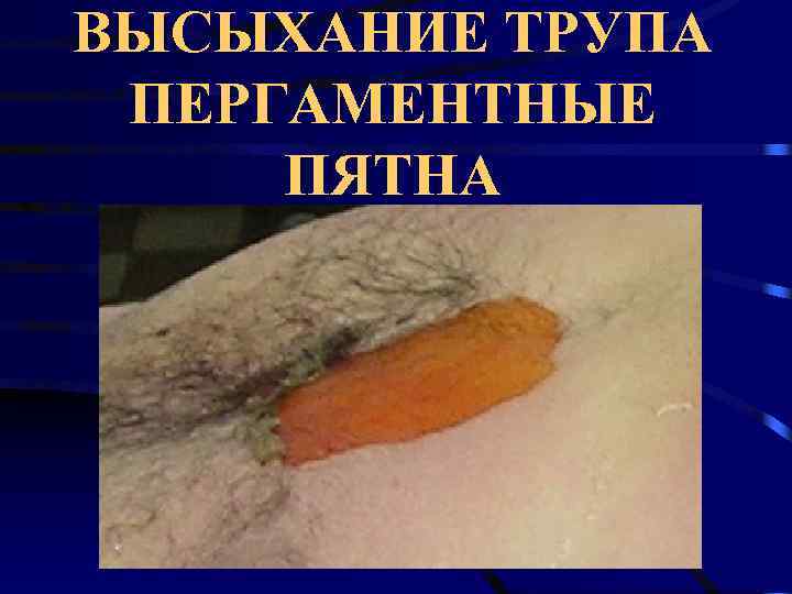 ВЫСЫХАНИЕ ТРУПА ПЕРГАМЕНТНЫЕ ПЯТНА 