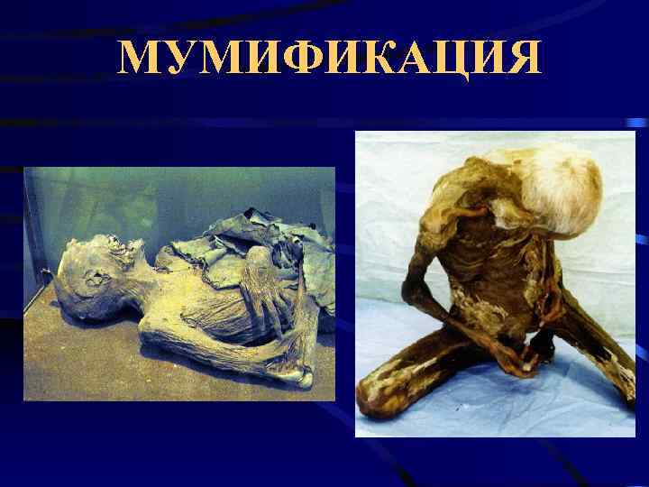 МУМИФИКАЦИЯ 