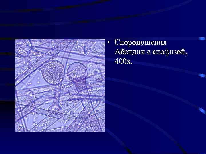  • Спороношения  Абсидии с апофизой,  400 х. 