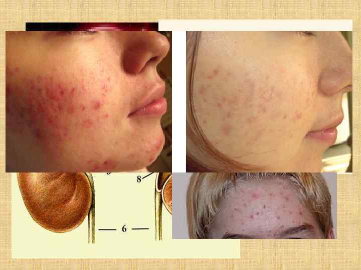 Многие лекарственные препараты, при всем своем положительном действии,  так же оказывают негативное воздействие