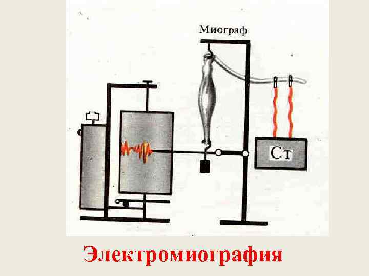 Электромиография 