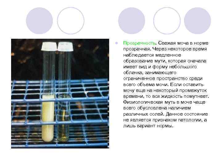 l  Прозрачность. Свежая моча в норме прозрачная. Через некоторое время наблюдается медленное образование