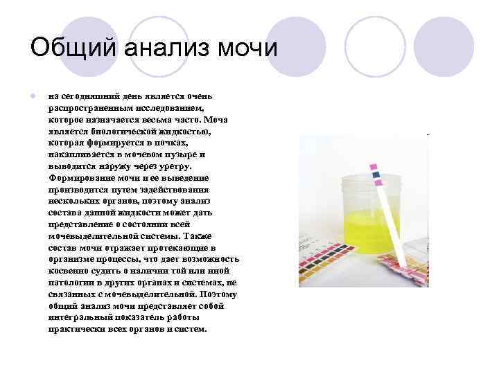 Общий анализ мочи l  на сегодняшний день является очень распространенным исследованием, которое назначается