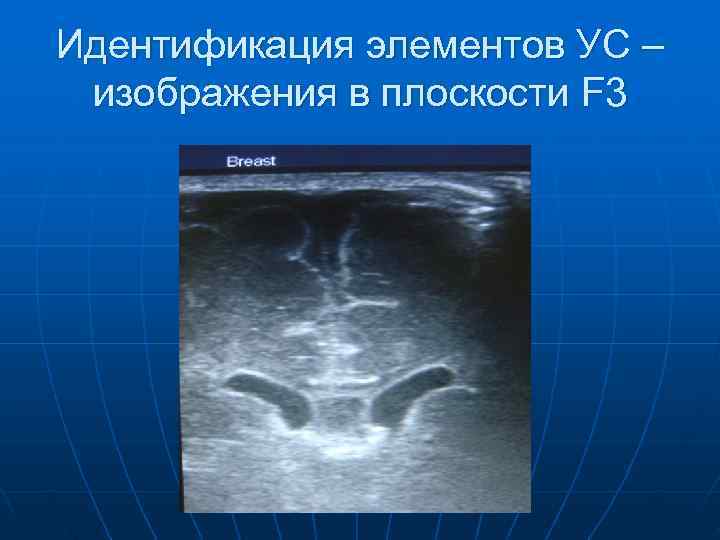 Идентификация элементов УС – изображения в плоскости F 3 