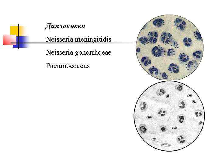 Диплококки Neisseria meningitidis Neisseria gonorrhoeae Pneumococcus 