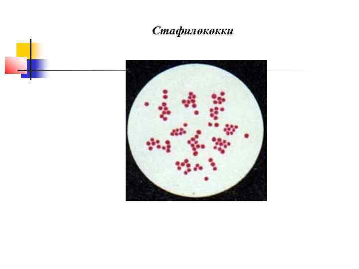 Стафилококки 