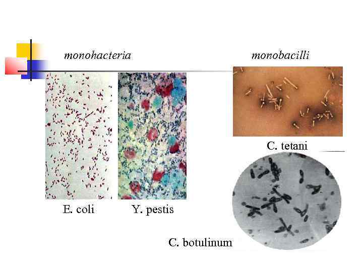 monohacteria     monobacilli    C. tetani E. coli 