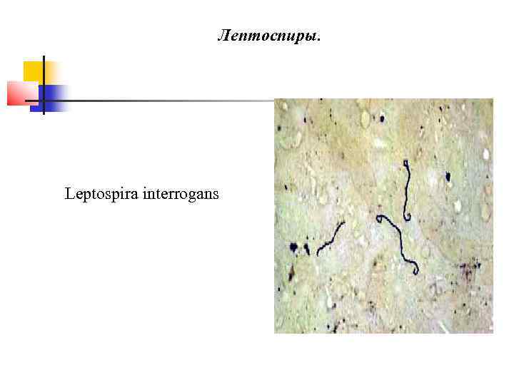      Лептоспиры. Leptospira interrogans 