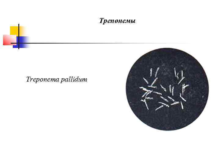      Трепонемы Treponema pallidum 