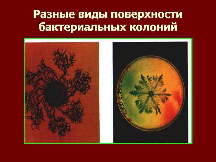 Разные виды поверхности бактериальных колоний 