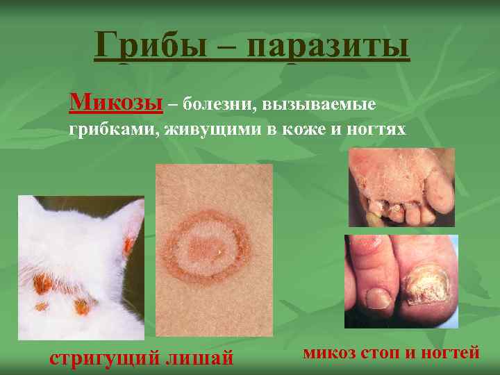   Грибы – паразиты Микозы – болезни, вызываемые  грибками, живущими в коже