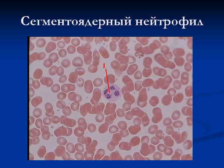 Сегментоядерный нейтрофил 