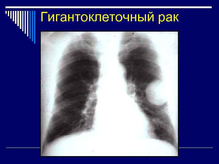 Справа образование. Шаровидное образование в легком. Очаговые образования в легких. S6 правого легкого очаговое образование. Образования 8 мм в легких.