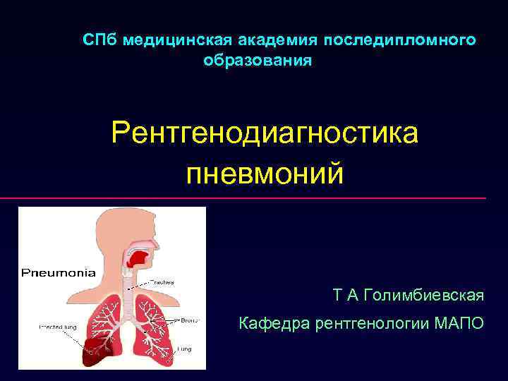 СПб медицинская академия последипломного   образования Рентгенодиагностика  пневмоний    