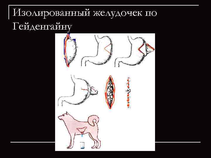 Схема операции изолированного желудочка по гейденгайну и по павлову