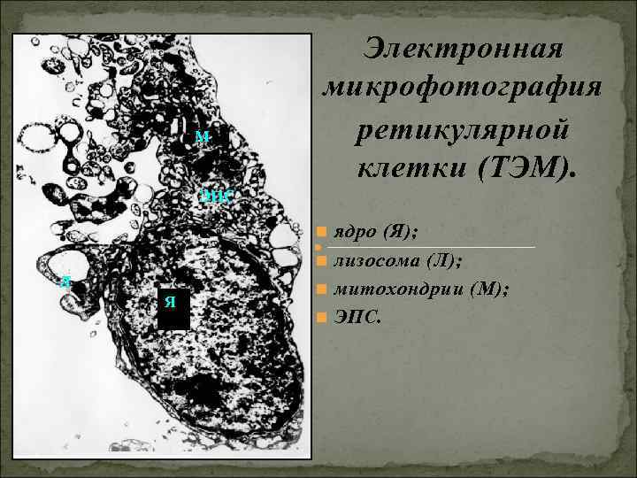 Электронная микрофотография М ретикулярной Электронная микрофотография М ретикулярной