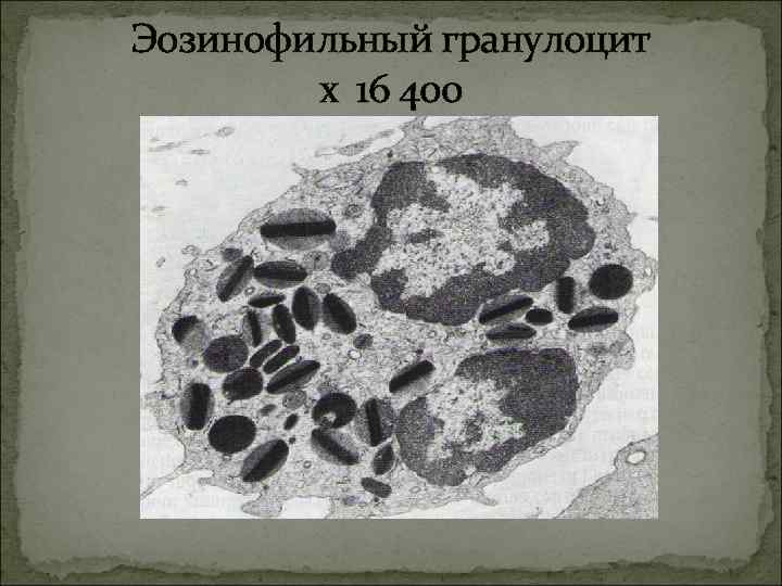 Эозинофильный гранулоцит х 16 400 Эозинофильный гранулоцит х 16 400