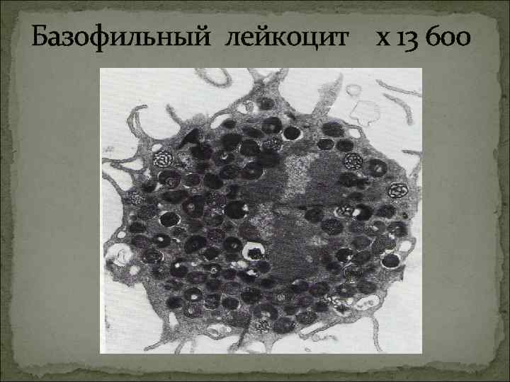 Базофильный лейкоцит х 13 600 Базофильный лейкоцит х 13 600
