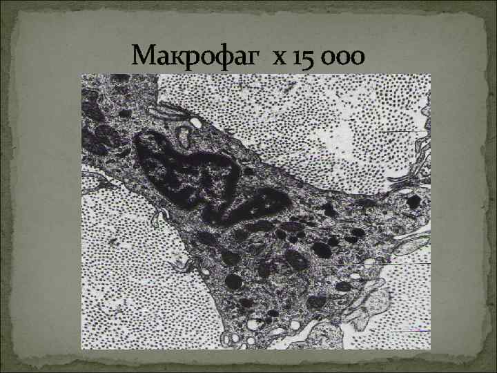Макрофаг х 15 000 Макрофаг х 15 000