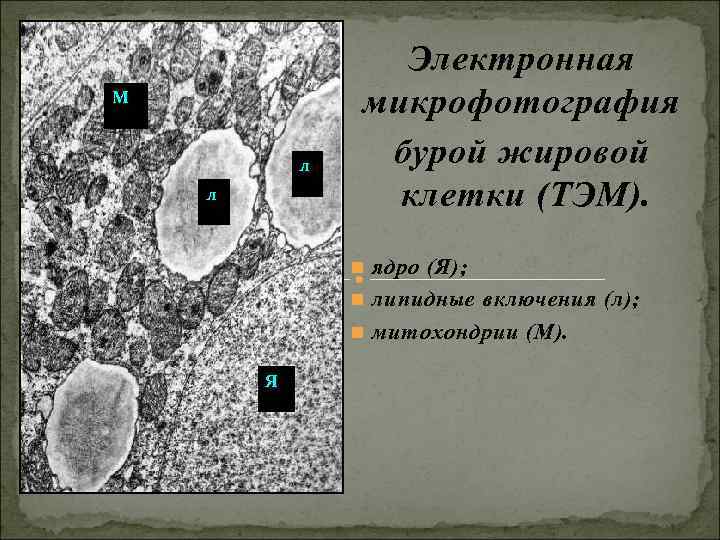 Электронная М микрофотография л бурой жировой Электронная М микрофотография л бурой жировой