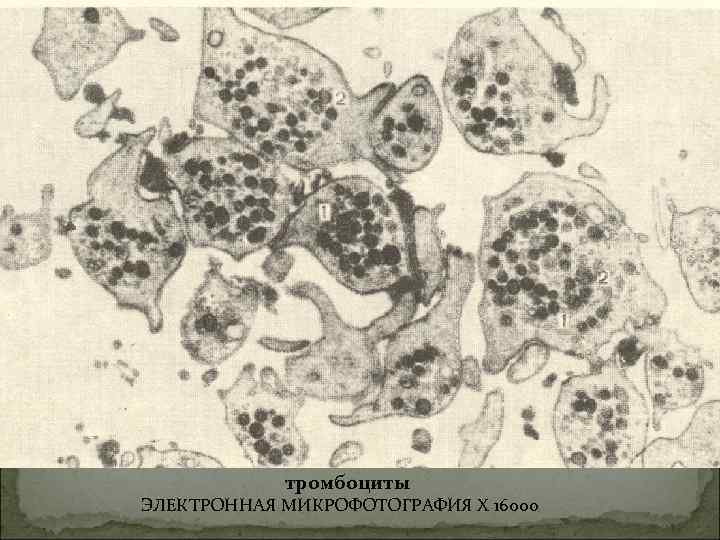 тромбоциты ЭЛЕКТРОННАЯ МИКРОФОТОГРАФИЯ X 16000 тромбоциты ЭЛЕКТРОННАЯ МИКРОФОТОГРАФИЯ X 16000