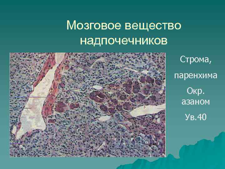 Пирамида мозгового вещества. Хромаффинные клетки надпочечников. Надпочечник мозговое вещество надпочечников. Надпочечники паренхима и Строма.