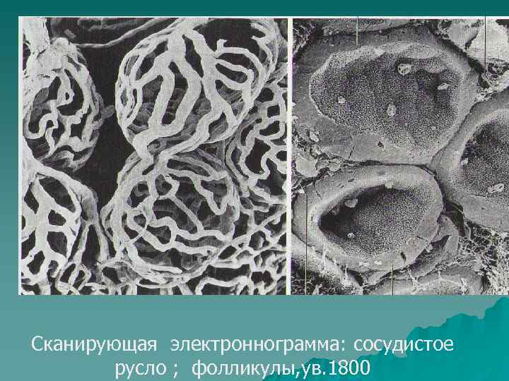 Сканирующая электроннограмма: сосудистое   русло ; фолликулы, ув. 1800 