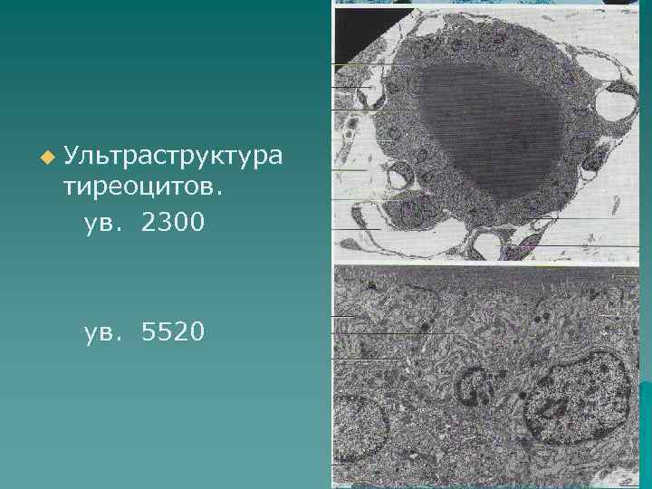 u  Ультраструктура тиреоцитов.  ув. 2300   ув. 5520 