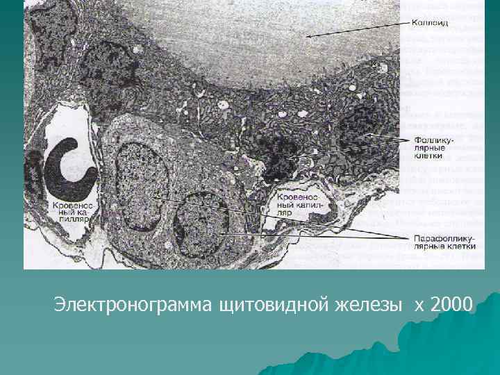 Электронограмма щитовидной железы х 2000 
