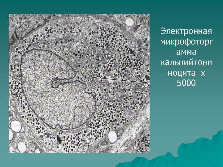 Электронная микрофоторг амма кальцийтони  ноцита х 5000 
