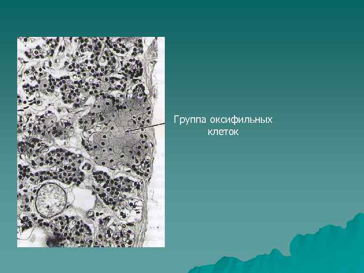Группа оксифильных  клеток 