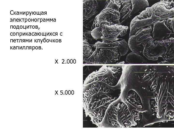 Сканирующая электронограмма подоцитов, соприкасающихся с петлями клубочков капилляров.   Х 2. 000 