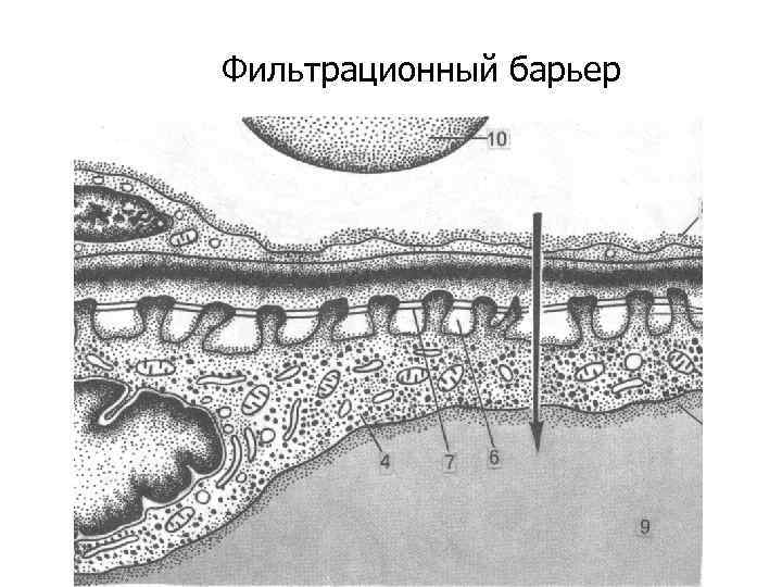 Фильтрационный барьер 