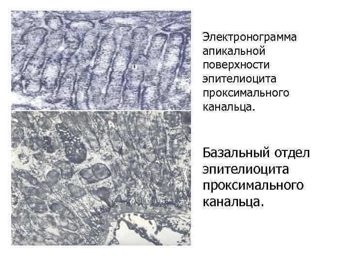 Электронограмма апикальной поверхности эпителиоцита проксимального канальца. Базальный отдел эпителиоцита проксимального канальца. 