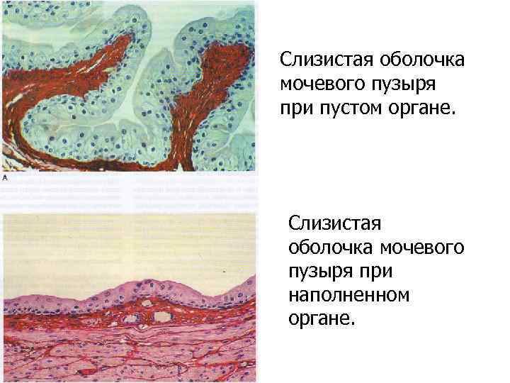 Слизистая оболочка мочевого пузыря при пустом органе. Слизистая оболочка мочевого пузыря при наполненном органе.