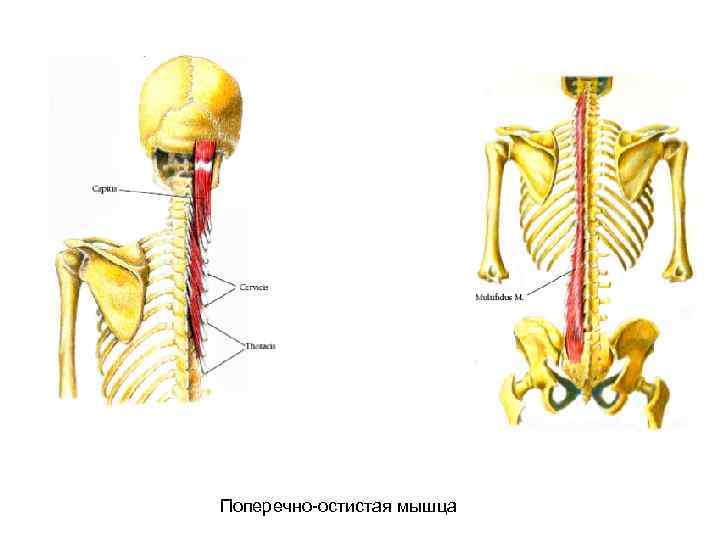 Поперечно-остистая мышца 