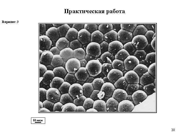      Практическая работа Вариант 3   10 мкм 