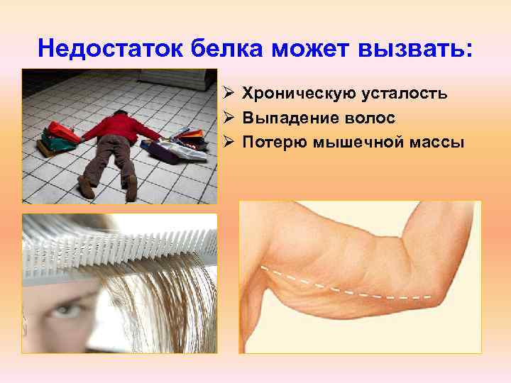 Недостаток белка может вызвать:    Ø Хроническую усталость   Ø Выпадение