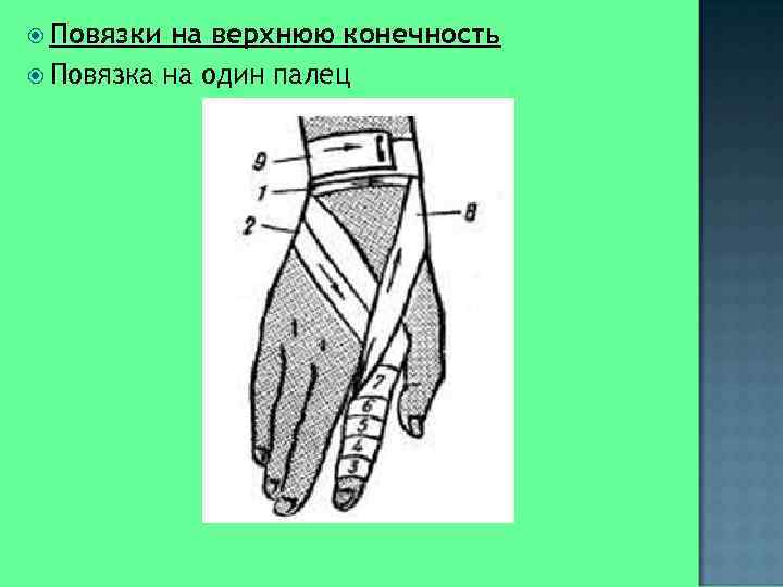  Повязки на верхнюю конечность  Повязка на один палец 