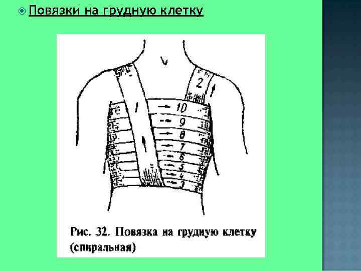 Окклюзионная повязка при пневмотораксе алгоритм. Повязка на грудную клетку. Спиральная повязка на грудную клетку. Наложение повязки на грудную клетку. Окклюзионные повязки на грудную клетку.