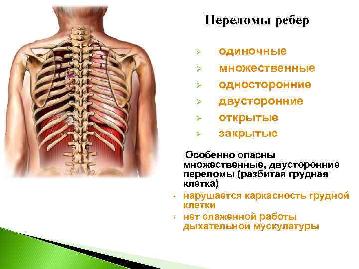    Переломы ребер  Ø одиночные  Ø множественные  Ø односторонние