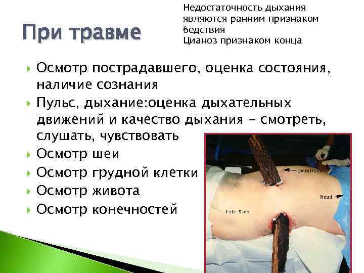     Недостаточность дыхания    являются ранним признаком При травме