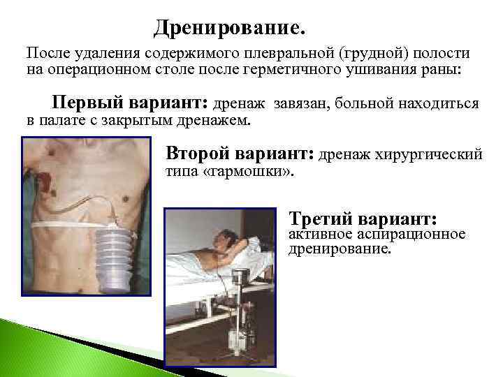     Дренирование. После удаления содержимого плевральной (грудной) полости на операционном столе